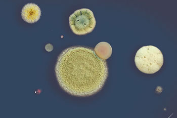 微生物群落多样性测序